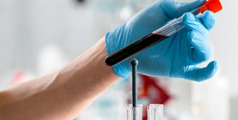 test veracity badanie prenatalne